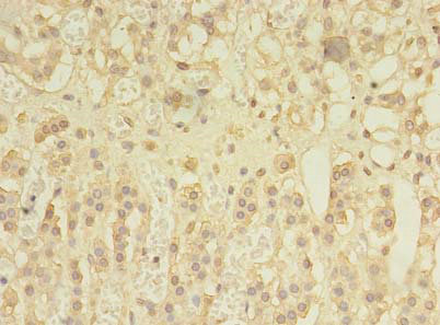 SPRY1 Polyclonal Antibody