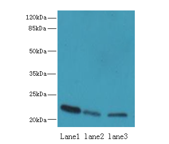 SSR3 Polyclonal Antibody