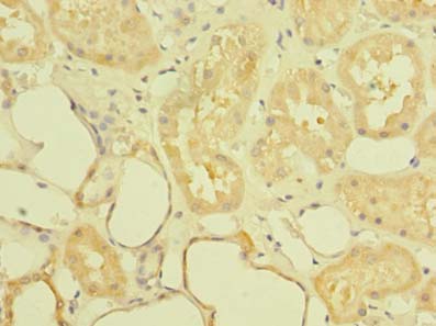 ST6GALNAC6 Polyclonal Antibody