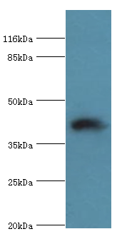STAC3 Polyclonal Antibody