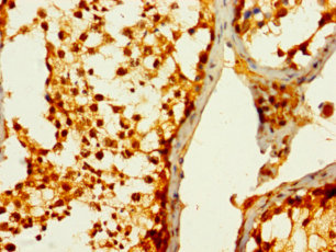 STC1 Polyclonal Antibody