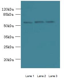 STK33 Polyclonal Antibody
