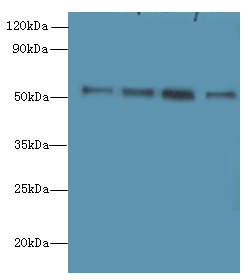 STK38L Polyclonal Antibody