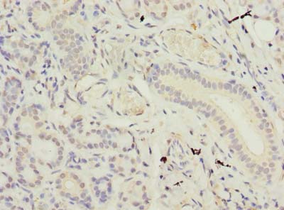 SUSD4 Polyclonal Antibody