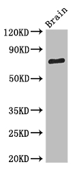 SV2B Polyclonal Antibody