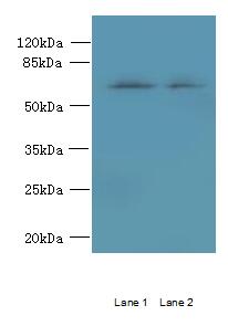 TBC1D19 Polyclonal Antibody