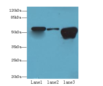 TBC1D22A Polyclonal Antibody