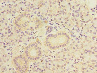 TBC1D9B Polyclonal Antibody