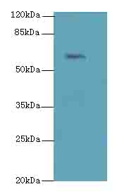 TBX15 Polyclonal Antibody