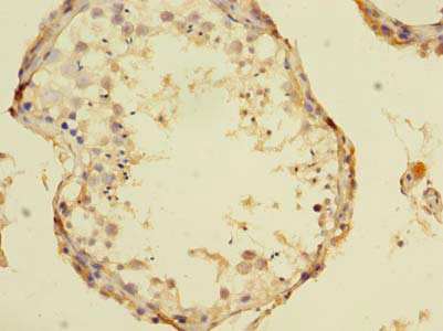 TCN1 Polyclonal Antibody