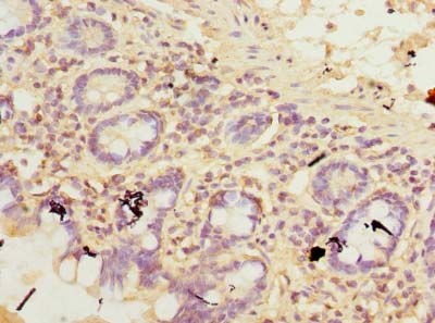 TCTEX1D2 Polyclonal Antibody