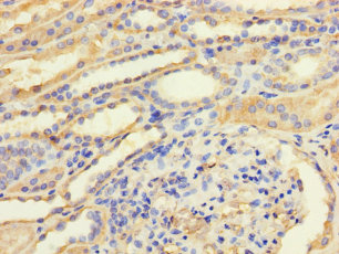 TGFB3 Polyclonal Antibody
