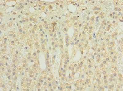 TIMM8B Polyclonal Antibody