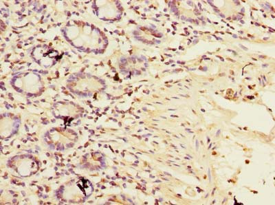 TIMM9 Polyclonal Antibody