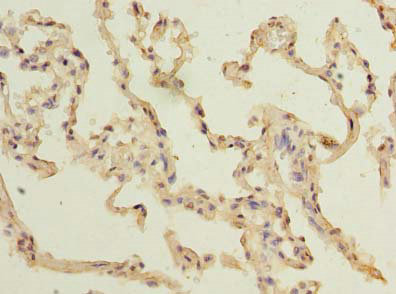 TM4SF1 Polyclonal Antibody