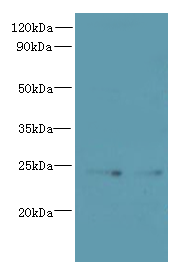 TMED2 Polyclonal Antibody