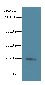 TMED3 Polyclonal Antibody