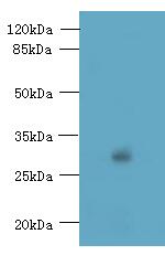 TMEM176B Polyclonal Antibody