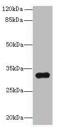 TMEM192 Polyclonal Antibody
