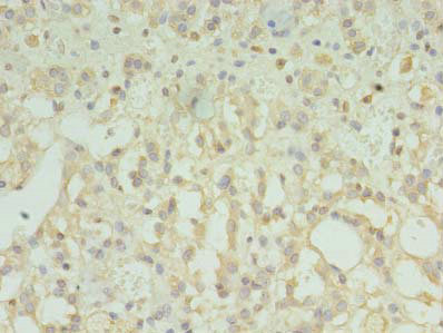 TMEM33 Polyclonal Antibody