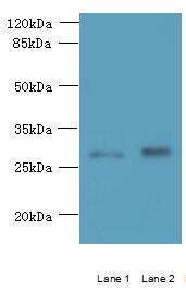 TMEM38B Polyclonal Antibody