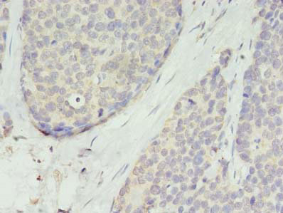 TMEM45A Polyclonal Antibody