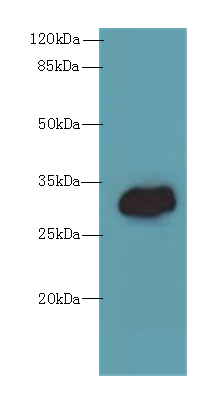 TMEM55A Polyclonal Antibody
