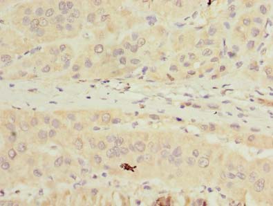 TMPRSS6 Polyclonal Antibody