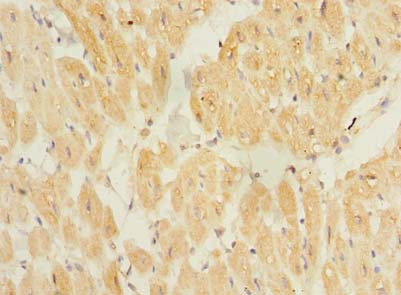 TP53TG5 Polyclonal Antibody