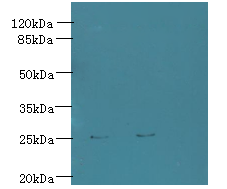 Trem2 Polyclonal Antibody
