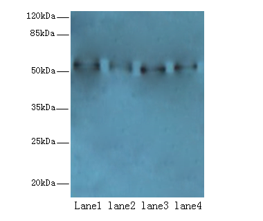 TRIM15 Polyclonal Antibody