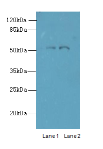 TRIM17 Polyclonal Antibody