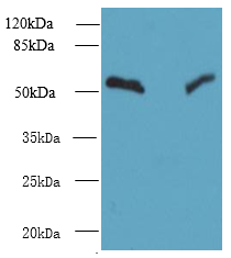 TRIT1 Polyclonal Antibody