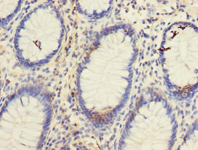 TSPAN1 Polyclonal Antibody