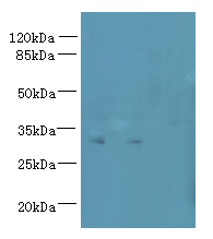 TSPAN5 Polyclonal Antibody