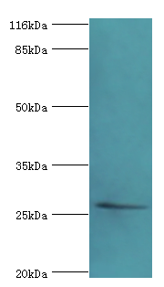 TSPAN6 Polyclonal Antibody