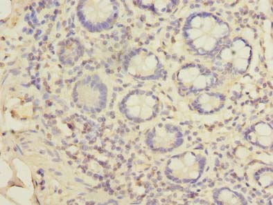 TSSC1 Polyclonal Antibody