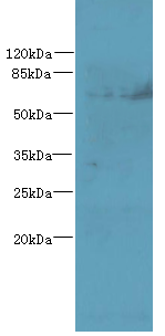 TTC30B Polyclonal Antibody