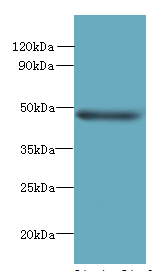 TTYH1 Polyclonal Antibody