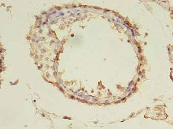 TUBA1A Polyclonal Antibody