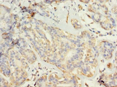 TUBG2 Polyclonal Antibody