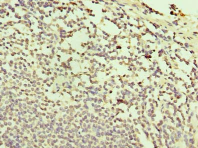 TXNDC11 Polyclonal Antibody
