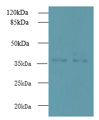 UBLCP1 Polyclonal Antibody