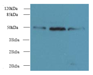UBXN6 Polyclonal Antibody