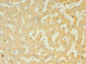 UGT2B4 Polyclonal Antibody
