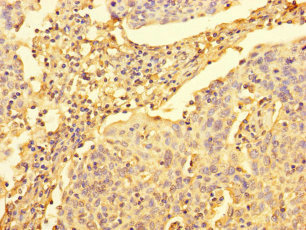 UPRT Polyclonal Antibody