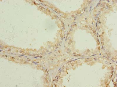USP47 Polyclonal Antibody