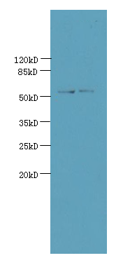 UTP15 Polyclonal Antibody