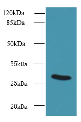 UTP23 Polyclonal Antibody