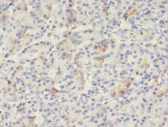 VWA5B2 Polyclonal Antibody (100 µl)